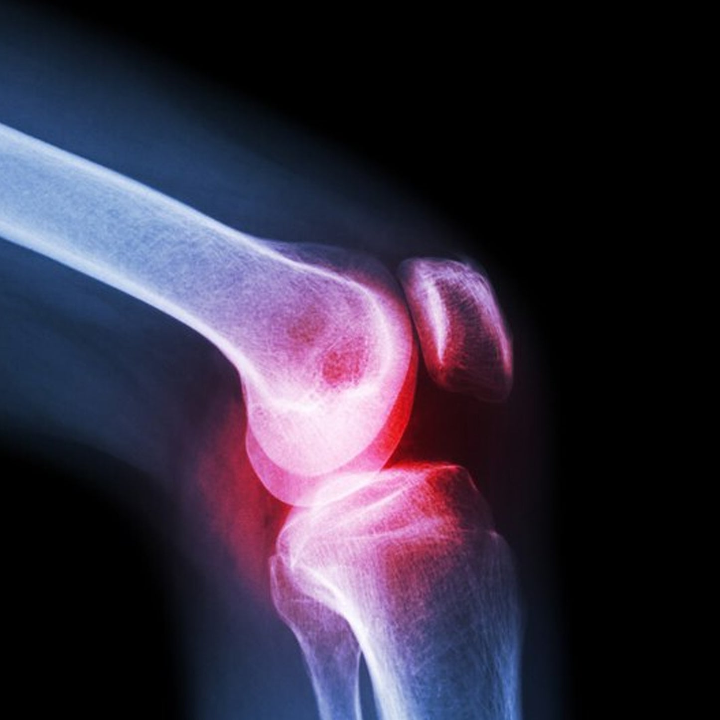 (Large) Knee Cap For Knee Support